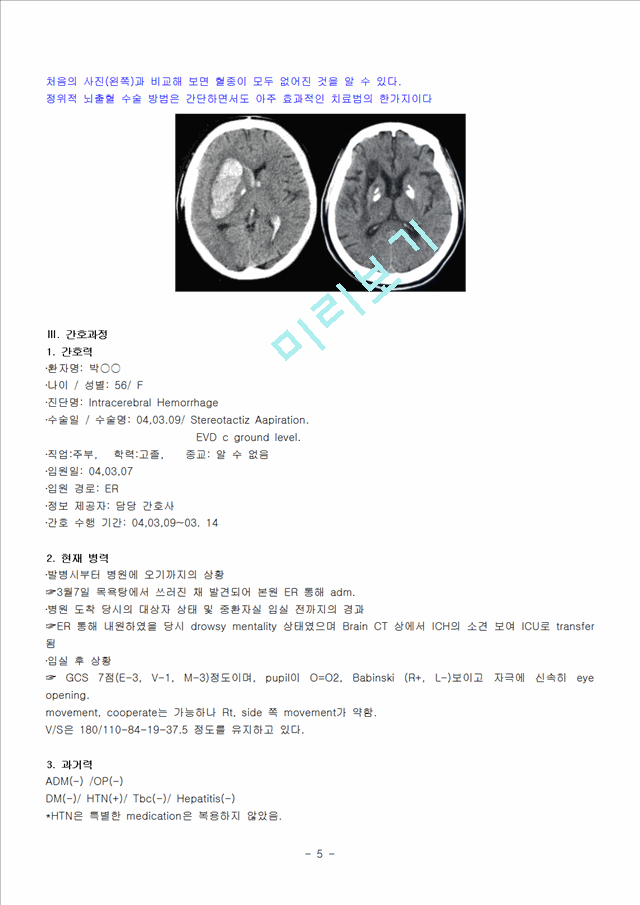 ICH-Intracerebral hemorrhage   (5 )